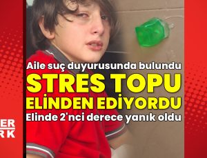 11 yaşındaki Furkan’ın elini patlayan stres topu yaktı! Suç duyurusu