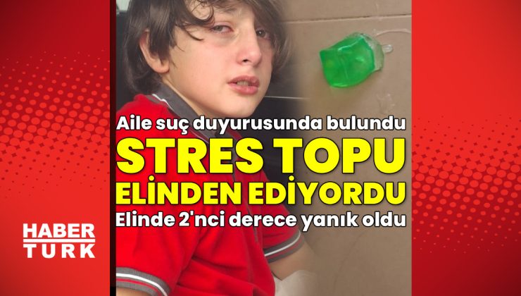 11 yaşındaki Furkan’ın elini patlayan stres topu yaktı! Suç duyurusu