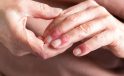 Atopik dermatitin görünmeyen yükü sanat eserleriyle görünür oldu