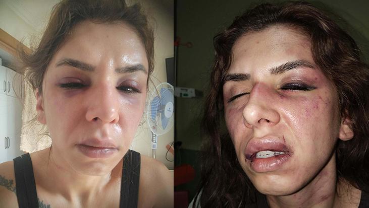İstanbul’da dehşet! Eşini saatlerce darbedip bıçakla tehdit ettiği iddiası: ‘Şehadet getir’