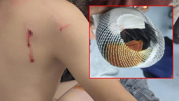 Başıboş köpek dehşeti! 8 yaşındaki çocuk hastanelik oldu