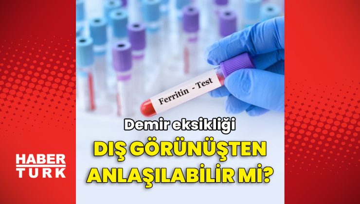 Demir eksikliği dış görünüşten anlaşılabilir mi?